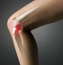 Артроскопия на коляното: защо тази процедура е необходима и как тя преминава