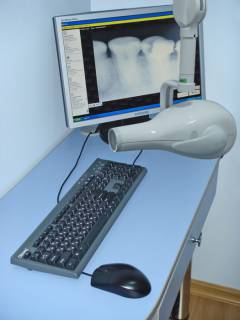 Опасност от рентгеново лъчение по време на бременност. Рентгеново изследване на белите дробове, зъбите, носа при ранна и късна бременност.