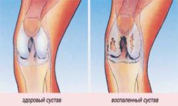 Болести на краката: какви са те и как да ги излекуваме