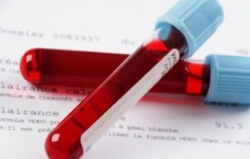 CRP в кръвта: какво е това и как да се подложи на изследването
