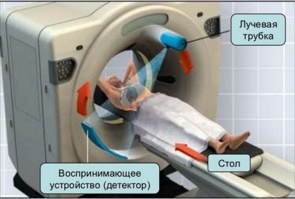 Как се извършва томографията?