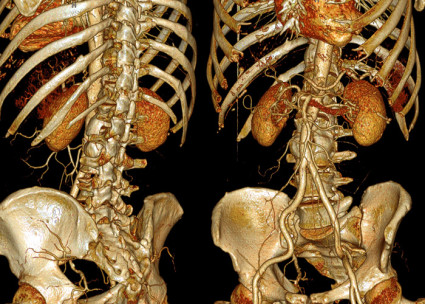 Сканиране на гръбначния стълб - точна и бърза диагноза
