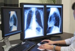 Рентгеново изследване на гръбнака: какво показва това проучване и кога трябва да мине