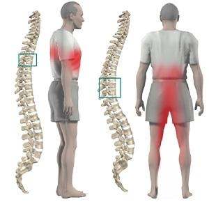 Причини за болка в мускулите на краката: заболявания, за които има такъв симптом