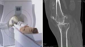 Компютърна томография (CT) на ставите: видове, които идентифицират и на които е противопоказано, разходите за процедурата в Москва