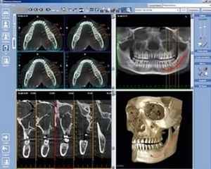 Компютърна томография (СТ) сканиране на челюстта: кога е необходимо, как се извършва, разновидностите и разходите за процедурата