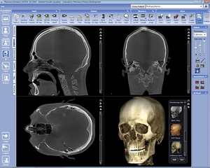 Компютърна томография (СТ) сканиране на челюстта: кога е необходимо, как се извършва, разновидностите и разходите за процедурата