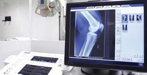 Рентген на колянната става: каква информация е дадена и колко вреден, къде да се направи, цената в Москва
