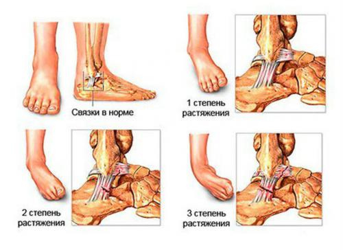 Разтягане на връзките на краката (ставите на коляното и глезена)