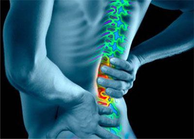 Остеохондроза на гръбнака с радикуларен синдром