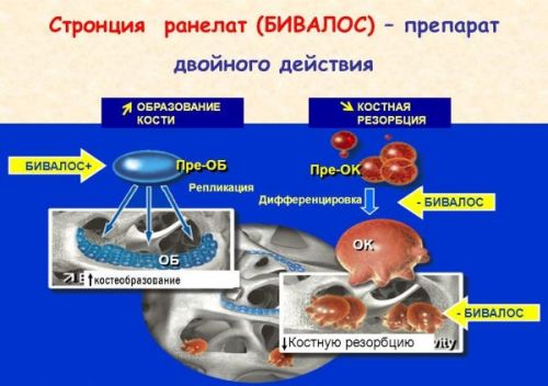 Постменопаузална остеопороза