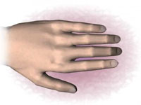 Какво представлява бурсит на пръстите и как да се лекува?