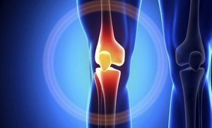 Болести на колянната става: характеристики и методи на лечение