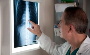 Деформация на гръдния кош във формата на фуния: причини, степени, симптоми и лечение на това заболяване