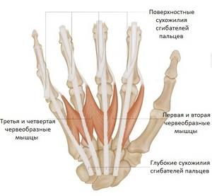 Ръчни карпални сухожилия: анатомична структура, възможни заболявания и тяхното лечение
