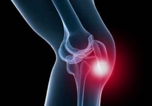 Болка в коляното при ходене: защо възниква и какво да прави