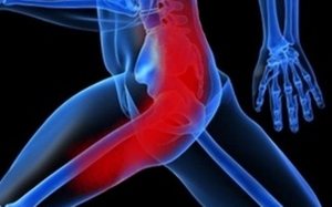 Болка в мускулите на бедрото: причината за появата им и как да се лекува