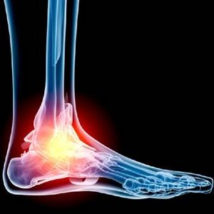 Тендовагинит на крака: причини, симптоми и методи на лечение