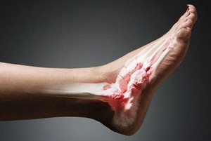 Петата боли от вътрешността на крака: болести и състояния, които предизвикват този симптом