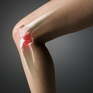 Кракът боли под коляното: какви са причините за дискомфорта и как да го премахнете?