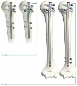 Остеосинтезата на раменната става и костта: когато е показано, видовете операция, нейната цена