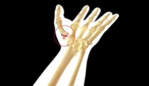 Палеца на ръката боли: за това какви травми и болести говорят такъв симптом