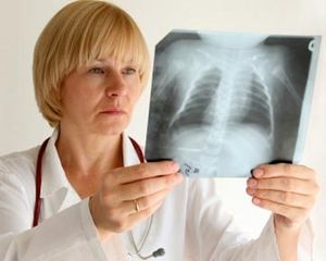Туберкулоза на костите и ставите: форми, причини, признаци и методи на лечение