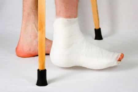 Симптоми и лечение на различни случаи на фрактура на крака