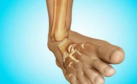 Травма на долните крайници: симптоми и лечение на разместване на крака