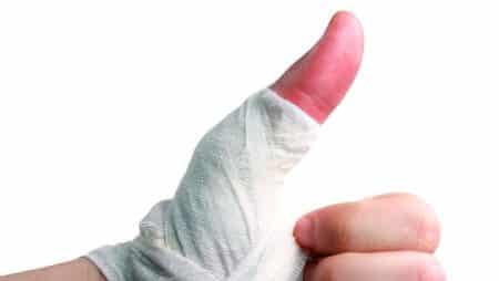 Лечение на фрактури на малкия пръст и други пръсти на ръката