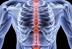 Остеохондроза на гръбначния стълб: признаци и лечение