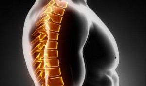 Гръдна остеохондроза: какви са причините за развитието, основните признаци, лечението