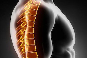 Гръдна остеохондроза: симптоми, усещания - как да разпознаете болестта