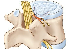 Причини и симптоми на задната дорзална издатина