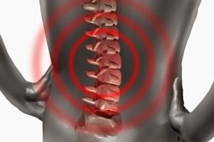 Възможно ли е да се разрешат състоянията на гръбначния стълб, при които хернията намалява или изчезва