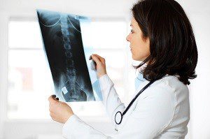 Дали рентгеновата диагностика е ефективна в херния на гръбначния стълб?