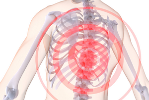 Херния на гръдния кош: това, което трябва да знаете за болестта