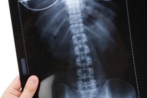 Как да установим наличието на патологии в гръбначния стълб с помощта на радиография