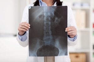 Как да установим наличието на патологии в гръбначния стълб с помощта на радиография
