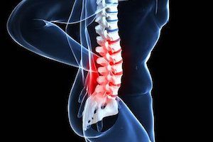 Повторение на гръбначния стълб - защо болестта се връща