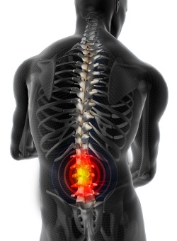 Протягане на гръбнака с херния на гръбначния стълб