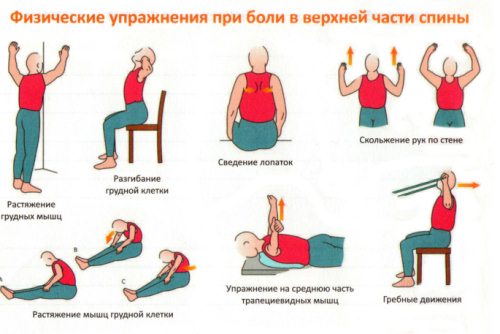 Най-ефективното упражняване на тренировъчна терапия за лечение на херния на гръбначния стълб