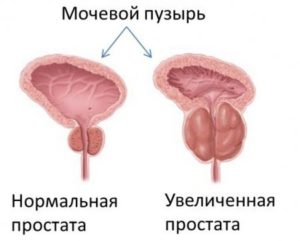 Болка в гърба от дясната страна и болка в долната част на корема вдясно