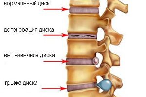 Болка в корема и гадене в долната част на гърба