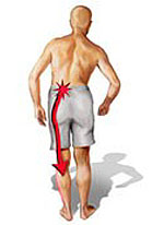 Болка в долната част на гърба и крака как да се лекува