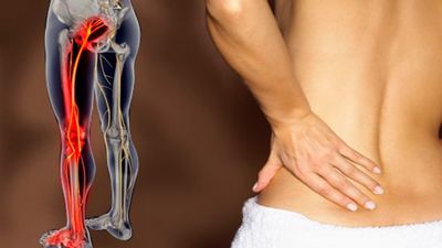 Болка в долната част на гърба и крака как да се лекува