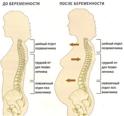 Болка в долната част на гърба бременност