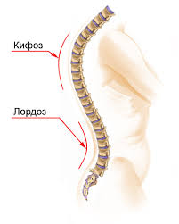 Лордоза или кифоза в гръбначния стълб