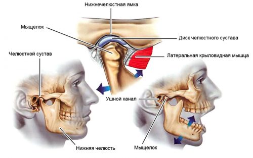 Temporomandibular joint artritis: симптоми и лечение