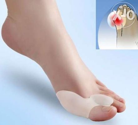 Причини и лечение на костите на крака